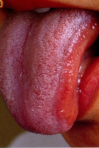 紫舌