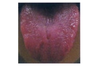 紅絳舌