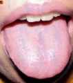 嫩舌(Tender Tongue)