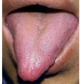 老舌