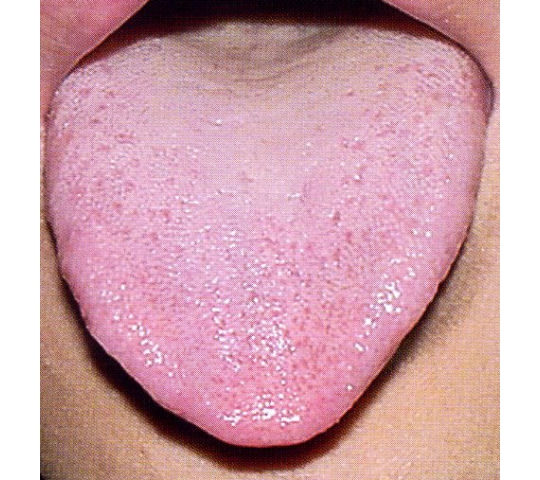 淡白舌