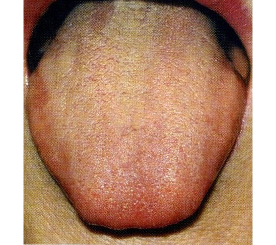 紅舌
